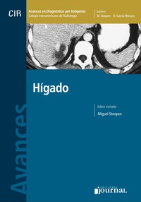 Omslagafbeelding: Avances en el diagnóstico por imágenes: Hígado 1st edition 9789871259212