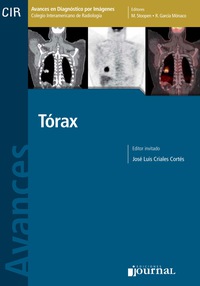 Cover image: Avances en diagnóstico por imágenes: Torax 1st edition 9789871259298