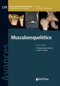 Cover image: Avances en diagnóstico por imágenes: Musculoesquelético 1st edition 9789871259335