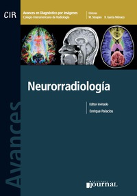 Cover image: Avances en diagnóstico por imágenes: Neurorradiología 1st edition 9789871259359