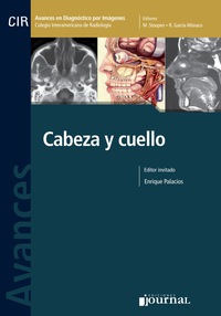 Cover image: Avances en diagnóstico por imágenes: Cabeza y cuello 1st edition 9789871259649