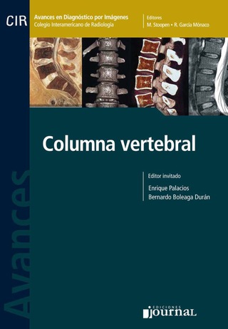 Titelbild: Avances en diagnóstico por imágenes: Columna vertebral 1st edition 9789871259762