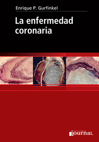 Omslagafbeelding: La enfermedad coronaria 1st edition 9789871259175