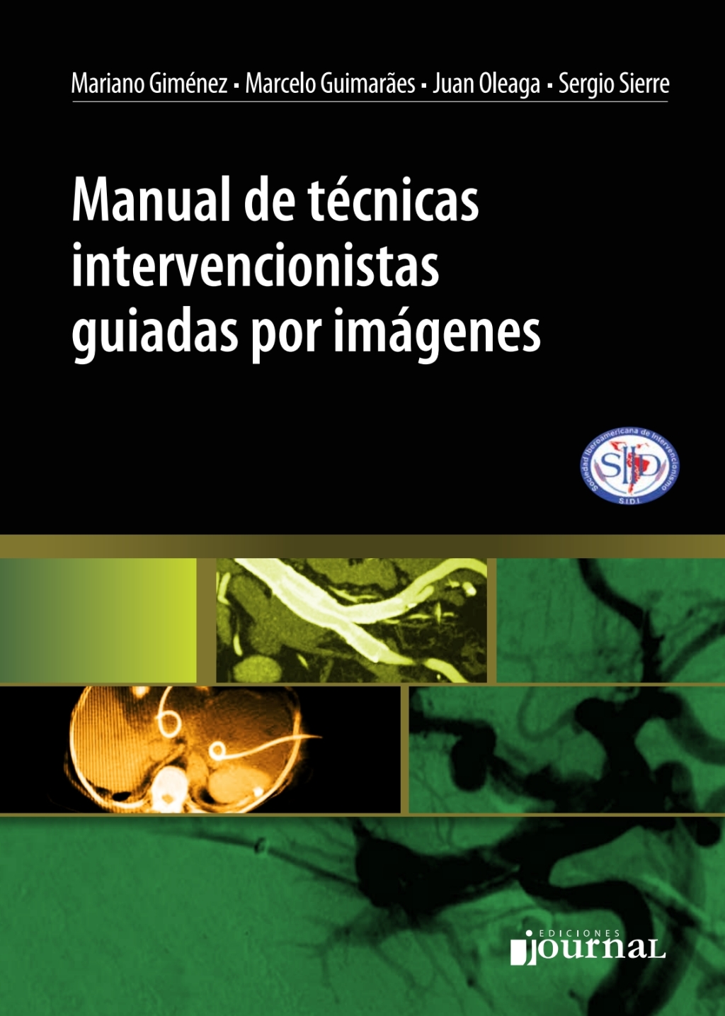 Manual de técnicas intervencionistas guiadas por imágenes 1st Edition