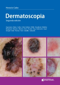 Cover image: Dermatoscopía 2nd edition 9789871259625