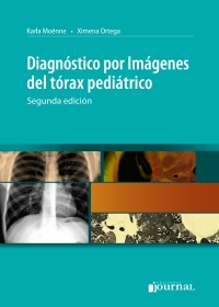Immagine di copertina: Diagnóstico por imágenes del tórax pediátrico 2nd edition 9789871259632