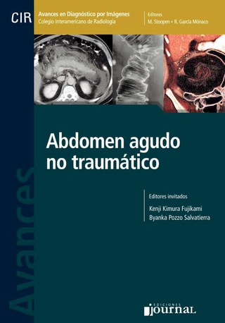 Cover image: Avances en diagnóstico por imágenes: Abdomen agudo no traumático 1st edition 9789871981571