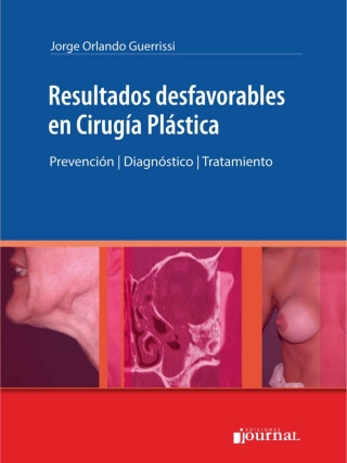 Imagen de portada: Resultados desfavorables en Cirugía Plástica 1st edition 9789871981687