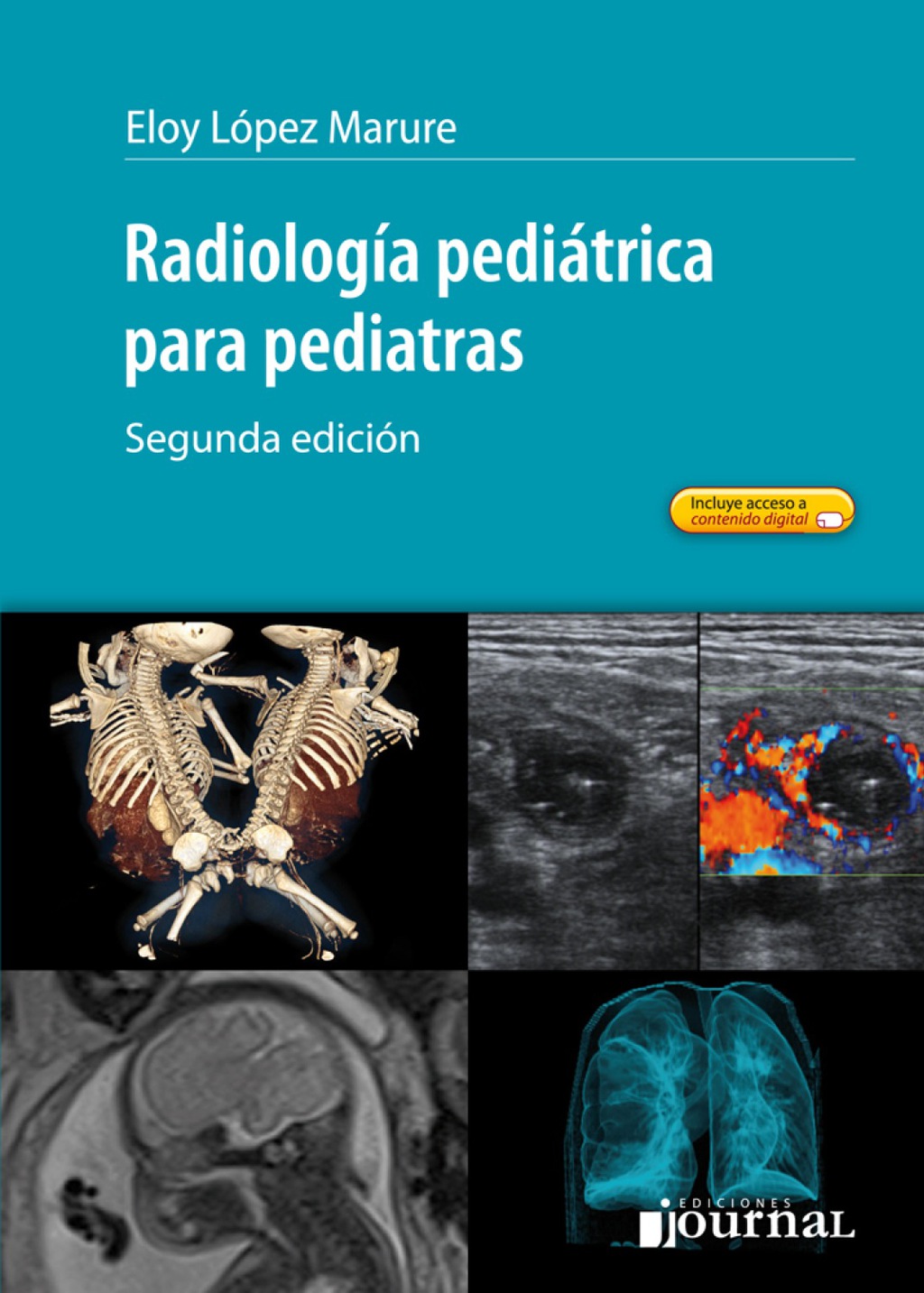 Radiología pediátrica para pediatras 2nd Edition