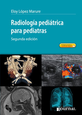 Cover image: Radiología pediátrica para pediatras 2nd edition 9789871981793