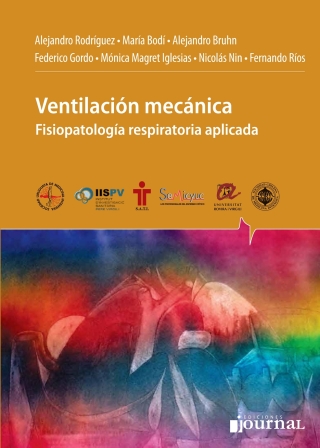 Omslagafbeelding: Ventilación Mecánica 1st edition 9789873954337