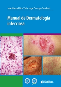Cover image: Manual de Dermatología infecciosa 1st edition 9789873954405