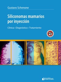 表紙画像: Siliconomas mamarios por inyección 1st edition n/a