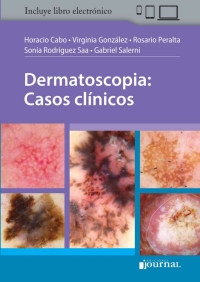 صورة الغلاف: Dermatoscopia - Casos clínicos 1st edition 9789873954887
