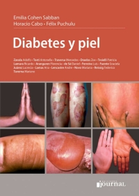 Cover image: Diabetes y piel 1st edition 9789873954658