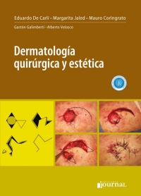 Omslagafbeelding: Dermatología quirúrgica y estética 1st edition 9789873954672