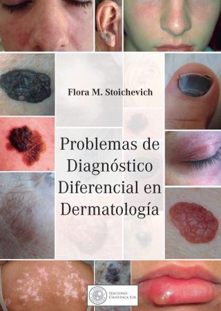 Imagen de portada: Problemas de Diagnostico Diferencial en Dermatologia 1st edition 9789874514929