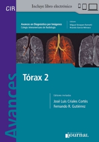 Imagen de portada: Tórax 2 1st edition 9789874922038
