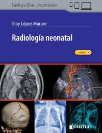 صورة الغلاف: Radiología Neonatal 1st edition 9789874922106