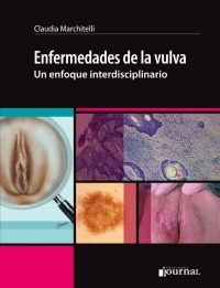 Cover image: Enfermedades de la vulva 1st edition 9789873954559