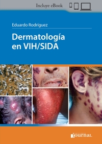Omslagafbeelding: Dermatología en VIH/Sida 1st edition 9789874922380