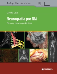 Imagen de portada: Neurografía por RM 1st edition 9789874922403
