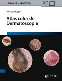 Cover image: Atlas color de Dermatoscopía 1st edition 9789874922410