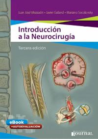 صورة الغلاف: Introducción a la Neurocirugía 3rd edition 9789874922427
