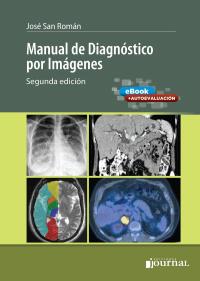 表紙画像:  Manual de Diagnóstico por Imágenes 2nd edition 9789874922625