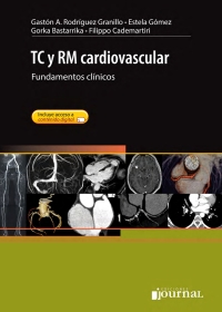Imagen de portada: TC y RM cardiovascular 1st edition 9789871981236