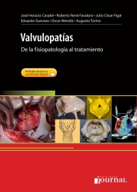 Omslagafbeelding: Valvulopatías 1st edition 9789871981243