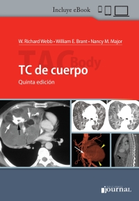 Imagen de portada: TC de cuerpo 5th edition 9789874922700