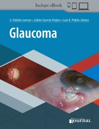 Cover image: Glaucoma 1st edition 9789874922724