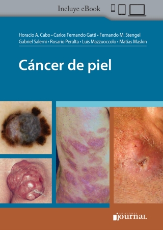 Cover image: Cáncer de piel 1st edition 9789874922816