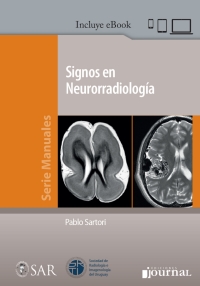 صورة الغلاف: Signos en Neurorradiología 1st edition 9789874922809
