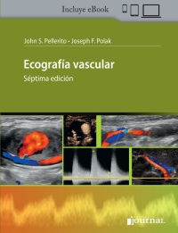 Cover image: Ecografía vascular 7th edition 9789874922854