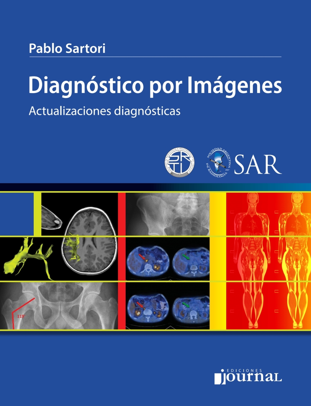 Diagnóstico por imágenes : actualizaciones diagnósticas 1st Edition