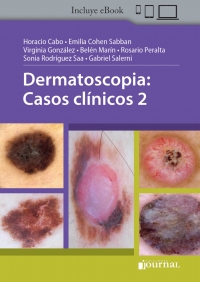 Cover image: Dermatoscopia: Casos clínicos 2 1st edition 9789874922946