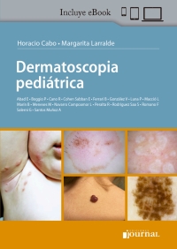 Imagen de portada: Dermatoscopia pediátrica 1st edition 9789878452012