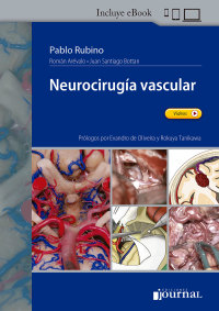 Cover image: Neurocirugía vascular 1st edition 9789878452067