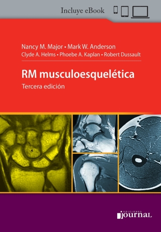 Cover image: Resonancia magnética musculoesquelética 3rd edition 9789878452104