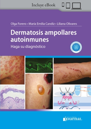 Omslagafbeelding: Dermatosis ampollares autoinmunes 1st edition 9789878452098