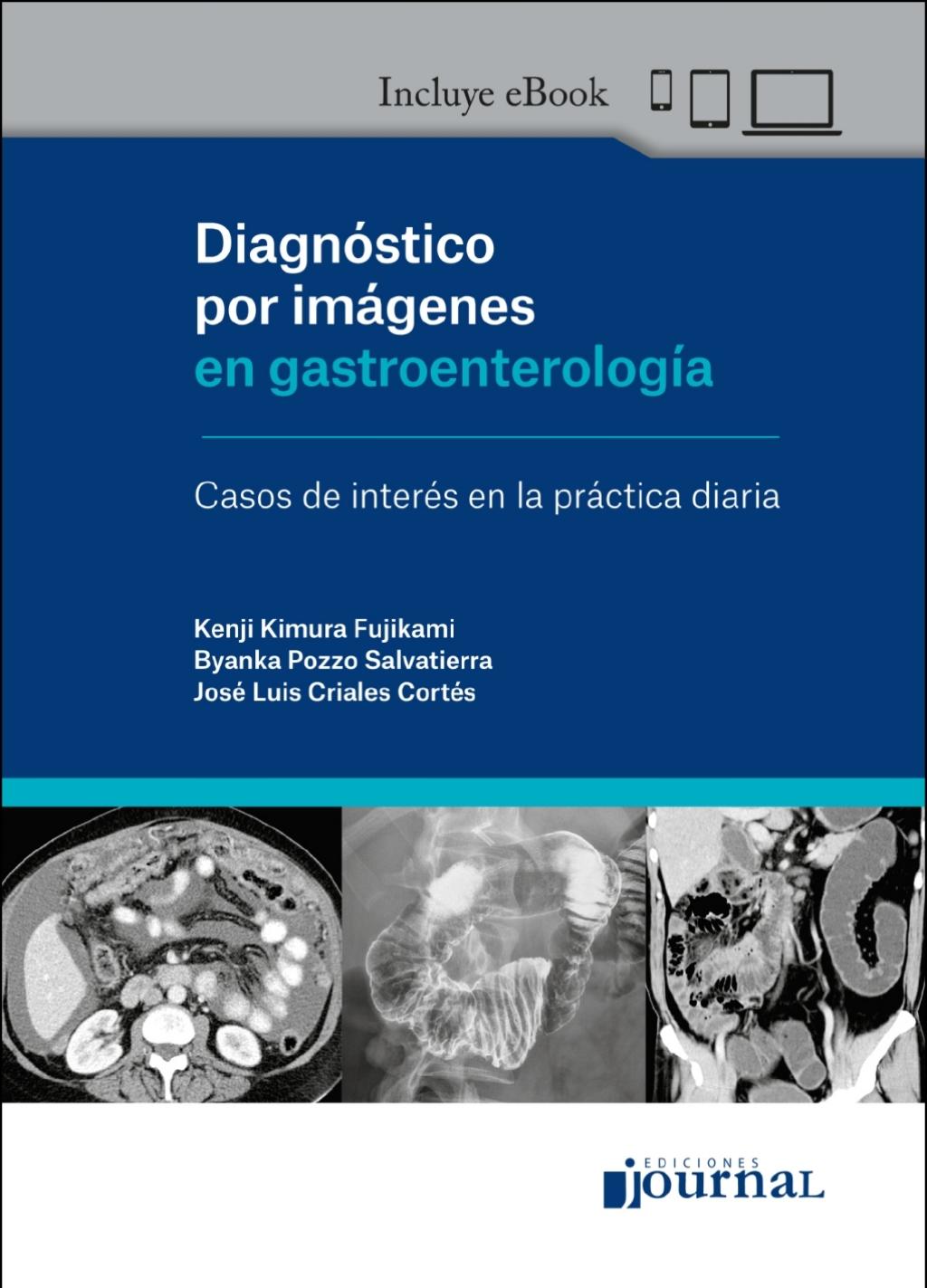 Diagnóstico por imágenes en gastroenterología 1st Edition