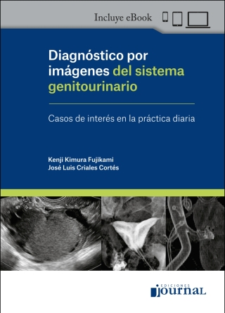 Cover image: Diagnóstico por imágenes del sistema genitourinario 1st edition 9789878452159