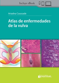 Imagen de portada: Atlas de enfermedades de la vulva 1st edition 9789878452210