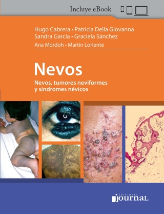 Imagen de portada: Nevos 1st edition 9789878452418