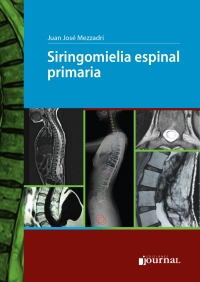 Imagen de portada: Siringomielia espinal primaria 1st edition 9789878452388