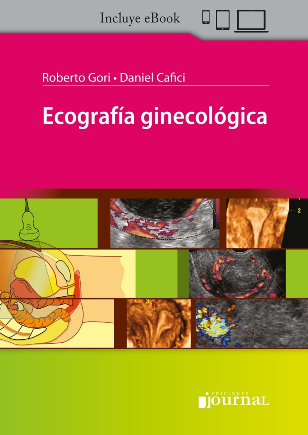 Ecografia ginecologica 1st Edition