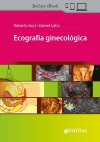 Cover image: Ecografia ginecologica 1st edition 9789878452562