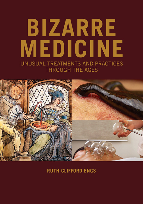 Bizarre Medicine: Unusual Treatments and Practices through the Ages, 1st Edition - FULL INSTANT DOWNLOAD | PDF DOCX EPUB